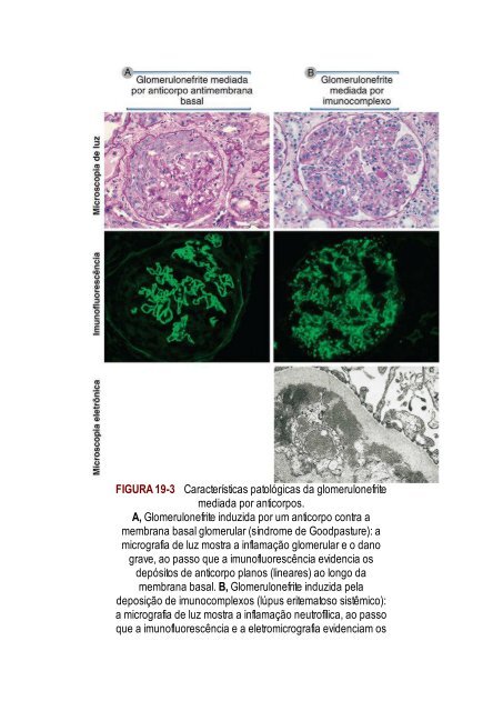 Abbas 8ed - Imunologia Celular e Molecular 