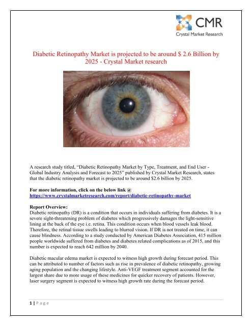 Diabetic Retinopathy Market - Industry Statistics Report 2025