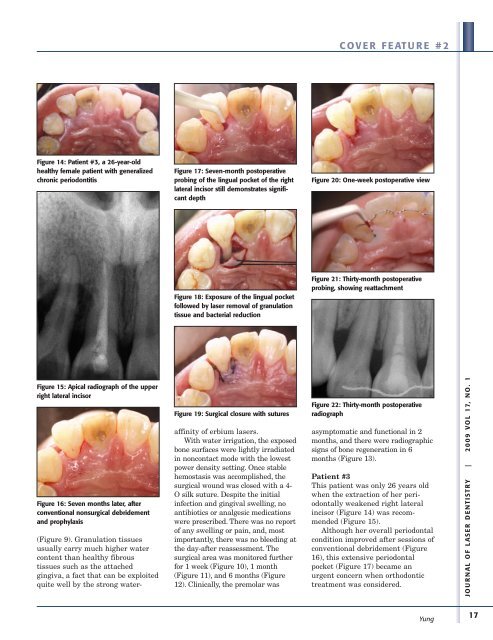 Dental Lasers - Academy of Laser Dentistry