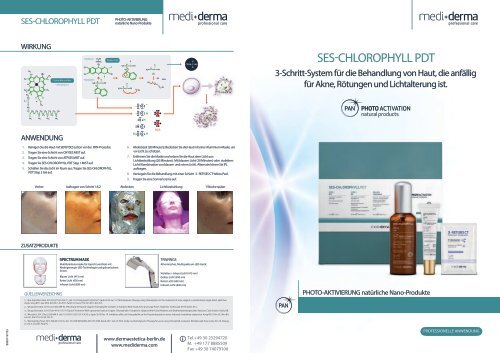 SES-CHLOROPHYLL PDT BROSCHÜRE