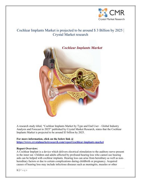 Cochlear Implants Market to Reach Valuation $ 3 Billion by 2025 - Crystal Market research