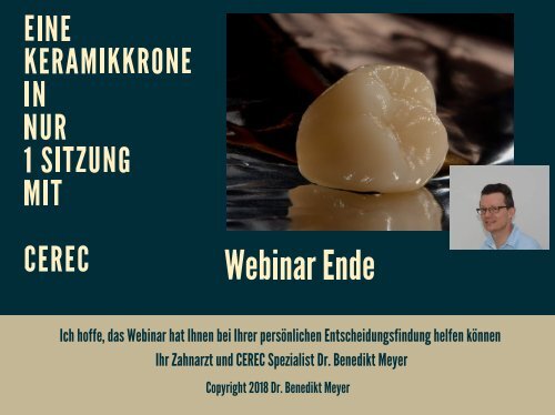 Eine Keramikkrone in nur 1 Sitzung mit CEREC Webinar