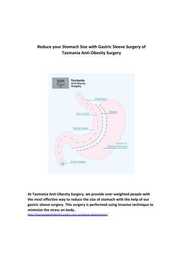 Reduce your Stomach Size with Gastric Sleeve Surgery of Tasmania Anti-Obesity Surgery