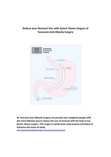 Reduce your Stomach Size with Gastric Sleeve Surgery of Tasmania Anti-Obesity Surgery