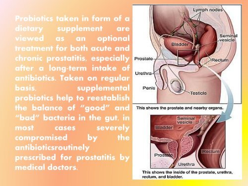 Prostatitis Treatment with Probiotics