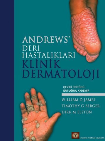 Andrews’ Deri Hastalıkları Klinik Dermatoloji