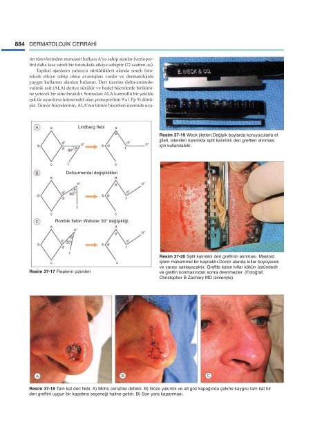 Andrews’ Deri Hastalıkları Klinik Dermatoloji