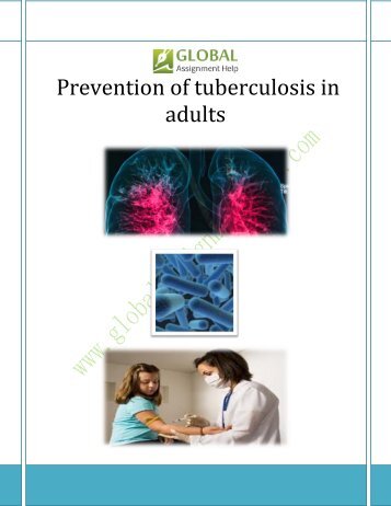 Prevention Methods and Treatment for Tuberculosis Disease