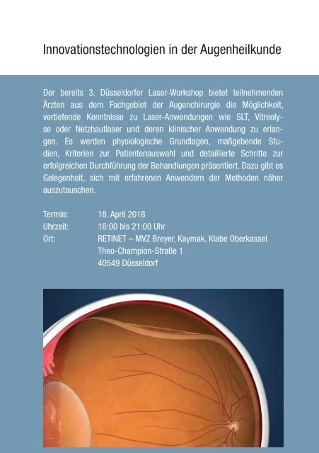 Laser-Workshop_Düsseldorf_April18