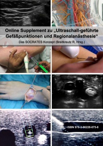 Dragon Procedure & Sonographie und Punktion Peripherer Venen - Online Supplement zum SOCRATES Kursmanual 2019