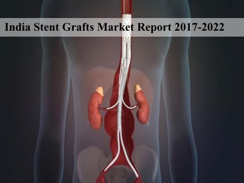 India Stent Grafts Market Report