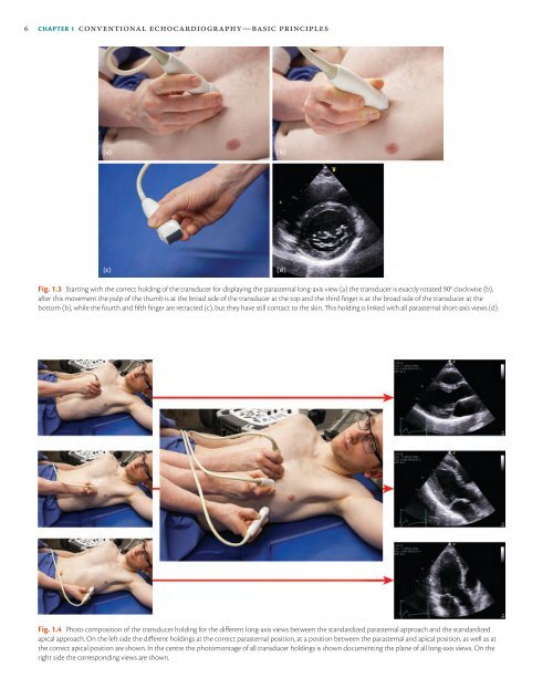 ESC Textbook of Cardiovascular Imaging - sample