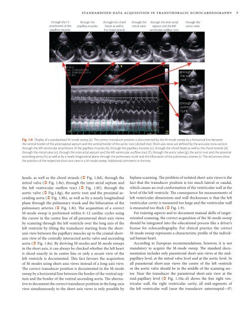 ESC Textbook of Cardiovascular Imaging - sample