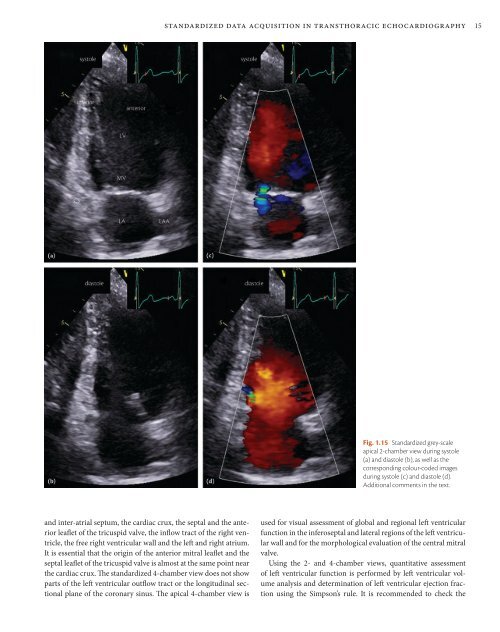 ESC Textbook of Cardiovascular Imaging - sample