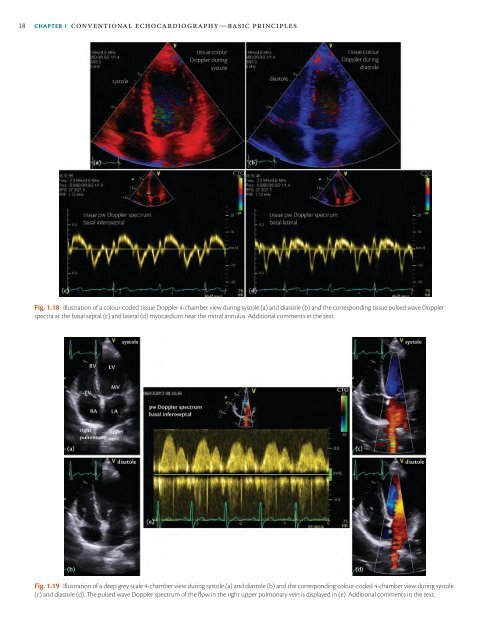 ESC Textbook of Cardiovascular Imaging - sample