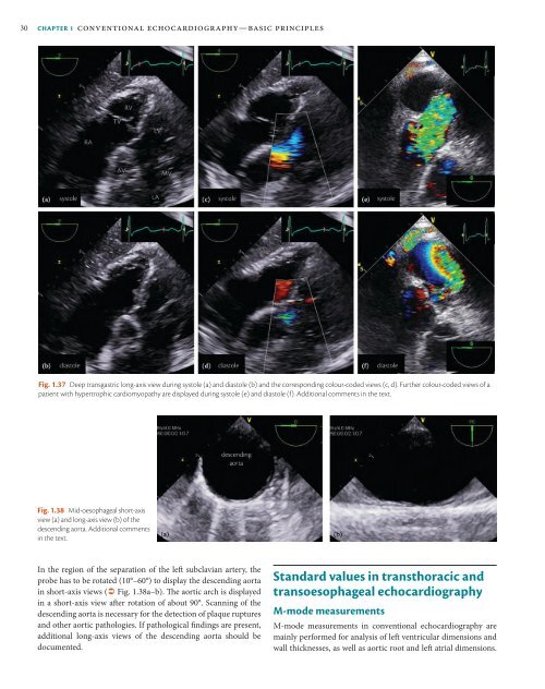 ESC Textbook of Cardiovascular Imaging - sample