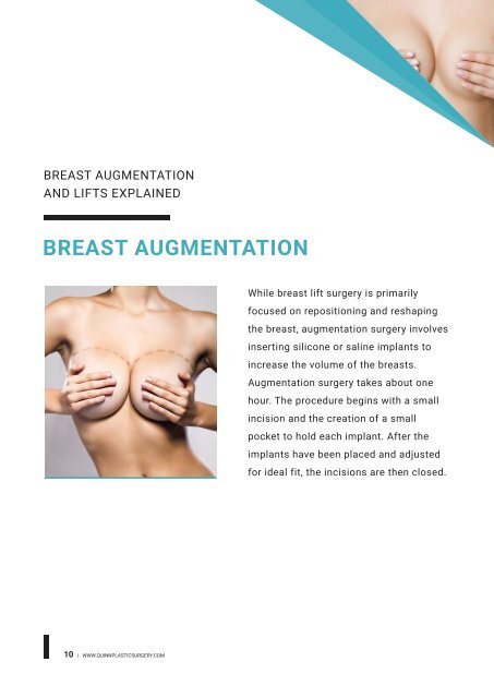 Breast-Template
