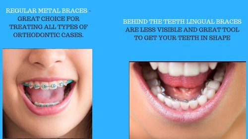 Orthodontist colorado springs