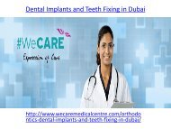 Dental Implants and Teeth Fixing in Dubai