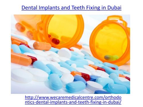 Dental Implants and Teeth Fixing in Dubai