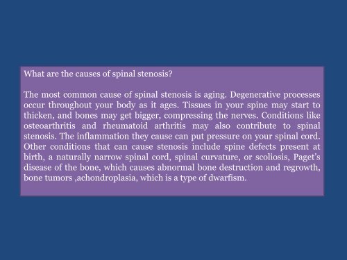Looking for the Spinal stenosis treatment