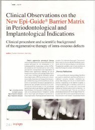 Clinical Observations on the New Epi-Guide