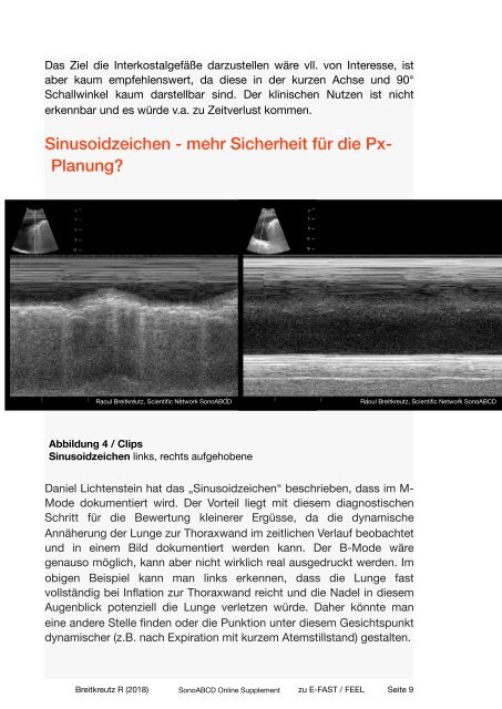 B-Probleme: Pleuraerguss und Pleurapunktion