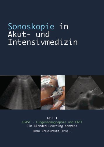 Sonoskopie eFAST: Lungensonographie und FAST (Online Auflage).