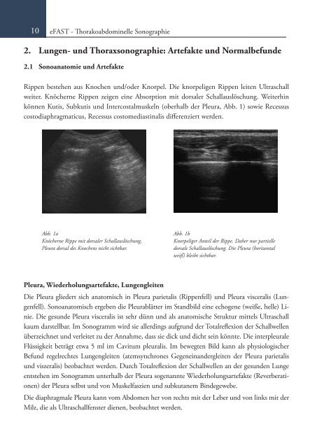 Sonoskopie eFAST: Lungensonographie und FAST (Online Auflage).