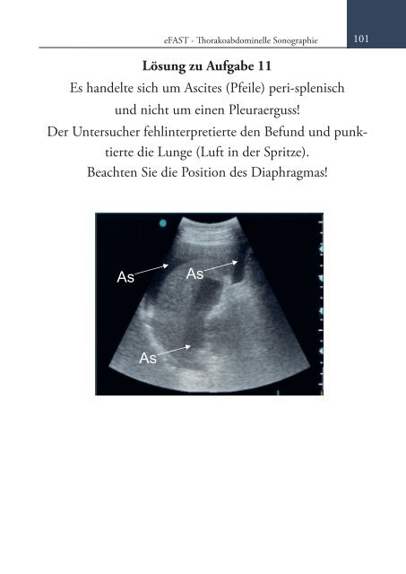 Sonoskopie eFAST: Lungensonographie und FAST (Online Auflage).