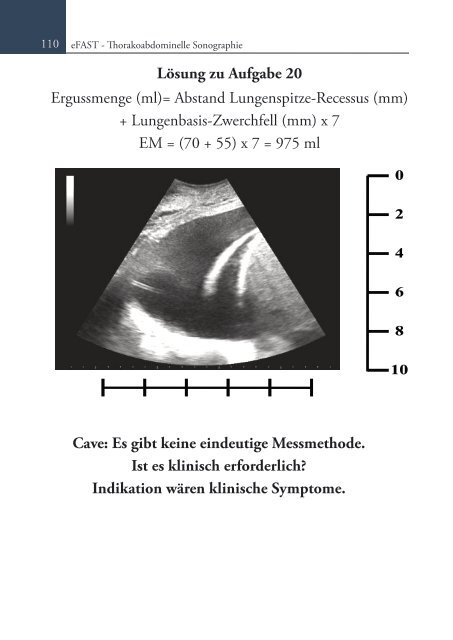 Sonoskopie eFAST: Lungensonographie und FAST (Online Auflage).