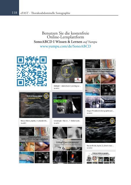 Sonoskopie eFAST: Lungensonographie und FAST (Online Auflage).