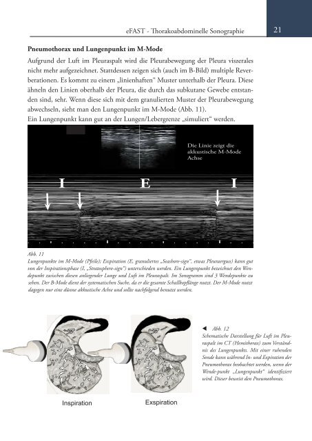 Sonoskopie eFAST: Lungensonographie und FAST (Online Auflage).