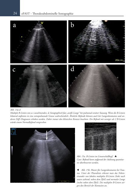 Sonoskopie eFAST: Lungensonographie und FAST (Online Auflage).