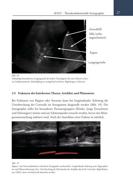 Sonoskopie eFAST: Lungensonographie und FAST (Online Auflage).