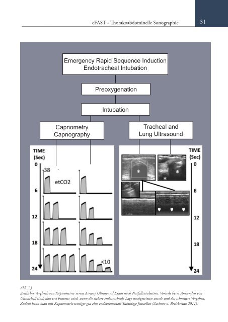 Sonoskopie eFAST: Lungensonographie und FAST (Online Auflage).