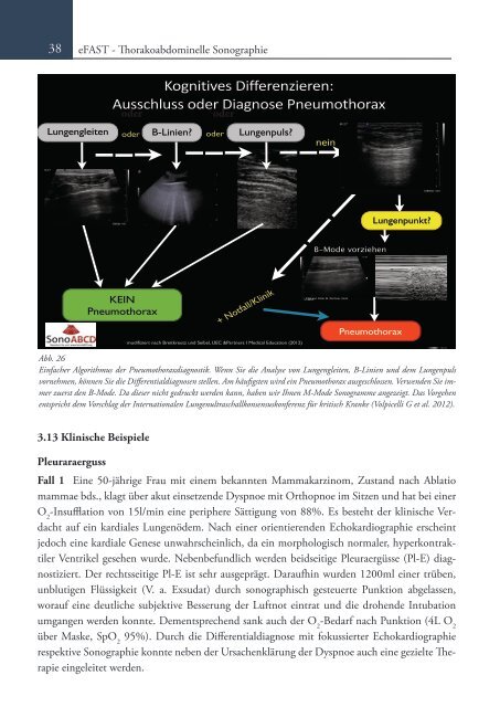 Sonoskopie eFAST: Lungensonographie und FAST (Online Auflage).