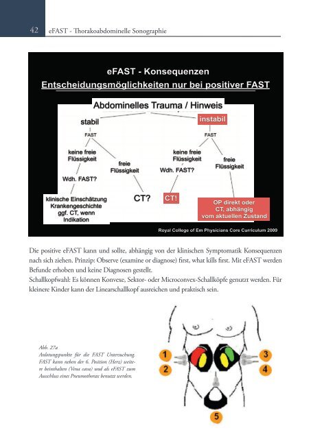 Sonoskopie eFAST: Lungensonographie und FAST (Online Auflage).