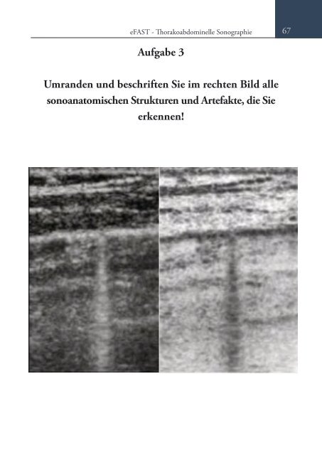 Sonoskopie eFAST: Lungensonographie und FAST (Online Auflage).