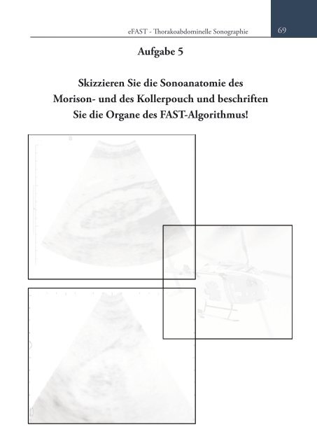 Sonoskopie eFAST: Lungensonographie und FAST (Online Auflage).