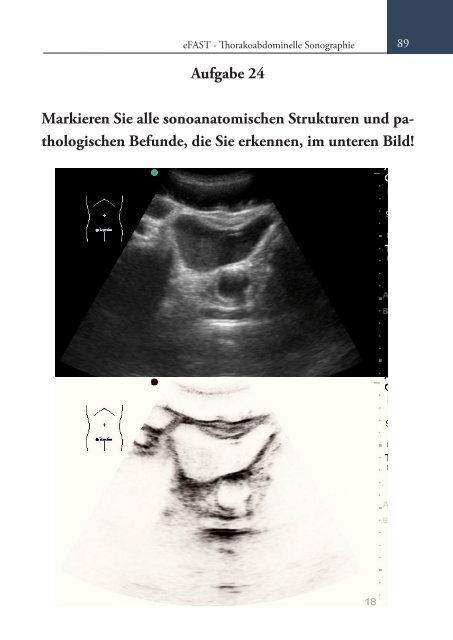 Sonoskopie eFAST: Lungensonographie und FAST (Online Auflage).