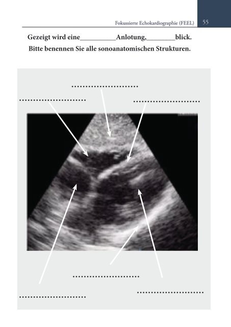 FEEL und Reanimationsultraschall, Fokussiertes Echo im Life Support. Ihr Einstieg? (Online Auflage).