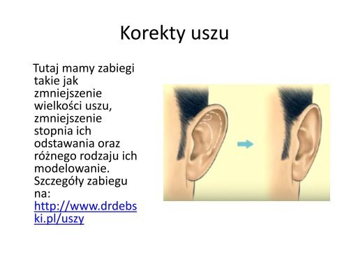 Operacje plastyczne nosa, biustu, uszu - najpopularniejsze zabiegi