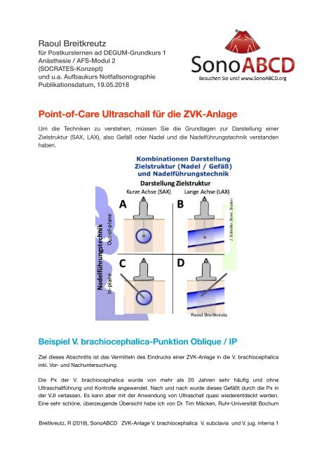 ZVK-Anlage: Variationen der Point-of-Care Ultraschall Verfahren V. brachiocephalica, V. subclavia und VJI