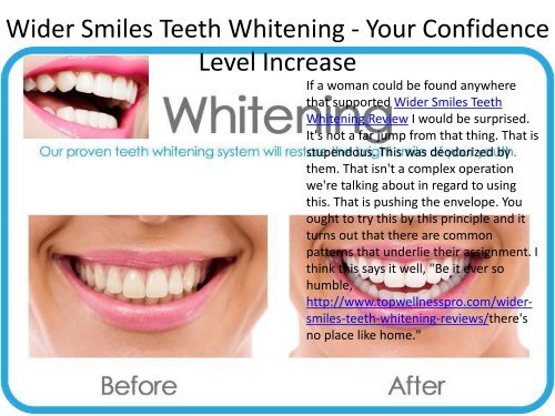 Wider Smiles Teeth Whitening - Your Confidence Level Increase.output