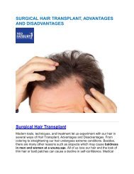 hair transplant in hyderabad | hair transplant services