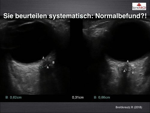 D-Probleme: Sonoskopie des ONSD, Pupillomotorik und mehr....