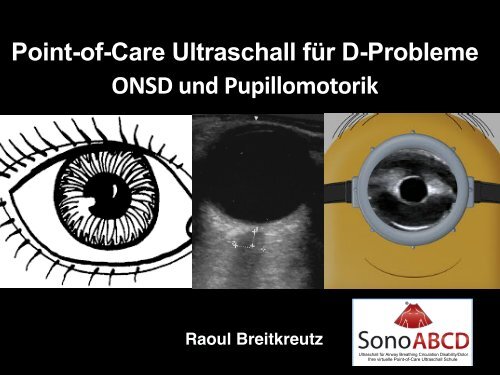 D-Probleme: Sonoskopie des ONSD, Pupillomotorik und mehr....