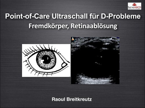 D-Probleme: Sonoskopie des ONSD, Pupillomotorik und mehr....