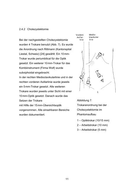 Die Übersichtsoptik - Experimentelle Minimal Invasive Chirurgie und ...